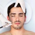 microdermoabrasion EN GUADALAJARA para HOMBRES | spa para hombres en guadalajara